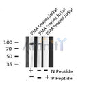 Western blot analysis of PKD2 (Phospho-Ser812) using PMA treated Jurkat whole cell lysates
