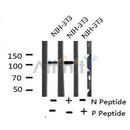 AF8094 at 1/200 staining Rat brain tissue sections by IHC-P. The tissue was formaldehyde fixed and a heat mediated antigen retrieval step in citrate buffer was performed. The tissue was then blocked and incubated with the antibody for 1.5 hours at 22¡ãC. An HRP conjugated goat anti-rabbit antibody was used as the secondary