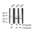 AF8095 at 1/200 staining Rat lung tissue sections by IHC-P. The tissue was formaldehyde fixed and a heat mediated antigen retrieval step in citrate buffer was performed. The tissue was then blocked and incubated with the antibody for 1.5 hours at 22¡ãC. An HRP conjugated goat anti-rabbit antibody was used as the secondary