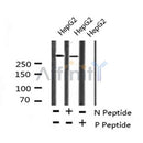 Western blot analysis of ATM (Phospho-Ser367) using HepG2 whole cell lysates