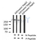 AF8100 at 1/200 staining Rat ganstric tissue sections by IHC-P. The tissue was formaldehyde fixed and a heat mediated antigen retrieval step in citrate buffer was performed. The tissue was then blocked and incubated with the antibody for 1.5 hours at 22¡ãC. An HRP conjugated goat anti-rabbit antibody was used as the secondary