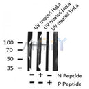 AF8101 staining SW626 by IF/ICC. The sample were fixed with PFA and permeabilized in 0.1% Triton X-100,then blocked in 10% serum for 45 minutes at 25¡ãC. The primary antibody was diluted at 1/200 and incubated with the sample for 1 hour at 37¡ãC. An Alexa Fluor 594 conjugated goat anti-rabbit IgG (H+L) Ab, diluted at 1/600, was used as the secondary antibod