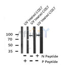AF8102 staining SW626 by IF/ICC. The sample were fixed with PFA and permeabilized in 0.1% Triton X-100,then blocked in 10% serum for 45 minutes at 25¡ãC. The primary antibody was diluted at 1/200 and incubated with the sample for 1 hour at 37¡ãC. An  Alexa Fluor 594 conjugated goat anti-rabbit IgG (H+L) Ab, diluted at 1/600, was used as the secondary antibod