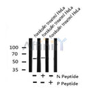 AF8103 staining Hela by IF/ICC. The sample were fixed with PFA and permeabilized in 0.1% Triton X-100,then blocked in 10% serum for 45 minutes at 25¡ãC. The primary antibody was diluted at 1/200 and incubated with the sample for 1 hour at 37¡ãC. An  Alexa Fluor 594 conjugated goat anti-rabbit IgG (H+L) Ab, diluted at 1/600, was used as the secondary antibod
