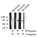 AF8132 staining Hela cells by IF/ICC. The sample were fixed with PFA and permeabilized in 0.1% Triton X-100,then blocked in 10% serum for 45 minutes at 25¡ãC. The primary antibody was diluted at 1/200 and incubated with the sample for 1 hour at 37¡ãC. An Alexa Fluor 594 conjugated goat anti-rabbit IgG (H+L) antibody(Cat.