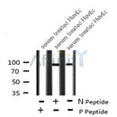 Western blot analysis FGFR3 (Phospho-Tyr760) using serum treated HuvEc whole cell lysates
