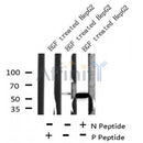 Western blot analysis of extracts from Hepg2, using NDR1/2 (Phospho-Thr444/442) Antibody. Lane 1 was treated with the blocking peptide.