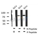AF8175 at 1/200 staining Rat kidney tissue sections by IHC-P. The tissue was formaldehyde fixed and a heat mediated antigen retrieval step in citrate buffer was performed. The tissue was then blocked and incubated with the antibody for 1.5 hours at 22¡ãC. An HRP conjugated goat anti-rabbit antibody was used as the secondary