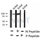 AF8220 staining Hela by IF/ICC. The sample were fixed with PFA and permeabilized in 0.1% Triton X-100,then blocked in 10% serum for 45 minutes at 25¡ãC. The primary antibody was diluted at 1/200 and incubated with the sample for 1 hour at 37¡ãC. An Alexa Fluor 594 conjugated goat anti-rabbit IgG (H+L) Ab, diluted at 1/600, was used as the secondary antibod