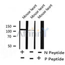 AF8239 at 1/200 staining Human ganstric cancer tissue sections by IHC-P. The tissue was formaldehyde fixed and a heat mediated antigen retrieval step in citrate buffer was performed. The tissue was then blocked and incubated with the antibody for 1.5 hours at 22¡ãC. An HRP conjugated goat anti-rabbit antibody was used as the secondary