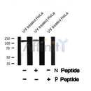 Western blot analysis USP28 (Phospho-Ser67) using UV treated HeLa whole cell lysates