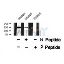 AF8391 staining HepG2 cells by IF/ICC. The sample were fixed with PFA and permeabilized in 0.1% Triton X-100,then blocked in 10% serum for 45 minutes at 25¡ãC. The primary antibody was diluted at 1/200 and incubated with the sample for 1 hour at 37¡ãC. An Alexa Fluor 594 conjugated goat anti-rabbit IgG (H+L) antibody(Cat.