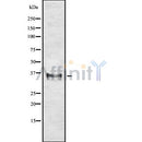 DF10283 staining Hela by IF/ICC. The sample were fixed with PFA and permeabilized in 0.1% Triton X-100,then blocked in 10% serum for 45 minutes at 25¡ãC. The primary antibody was diluted at 1/200 and incubated with the sample for 1 hour at 37¡ãC. An Alexa Fluor 594 conjugated goat anti-rabbit IgG (H+L) Ab, diluted at 1/600, was used as the secondary antibod