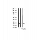 AF0663 staining Hela by IF/ICC. The sample were fixed with PFA and permeabilized in 0.1% Triton X-100,then blocked in 10% serum for 45 minutes at 25¡ãC. The primary antibody was diluted at 1/200 and incubated with the sample for 1 hour at 37¡ãC. An Alexa Fluor 594 conjugated goat anti-rabbit IgG (H+L) Ab, diluted at 1/600, was used as the secondary antibod