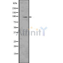DF7519 at 1/100 staining Mouse lung tissue by IHC-P. The sample was formaldehyde fixed and a heat mediated antigen retrieval step in citrate buffer was performed. The sample was then blocked and incubated with the antibody for 1.5 hours at 22¡ãC. An HRP conjugated goat anti-rabbit antibody was used as the secondary