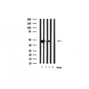 AF2016 staining HuvEc by IF/ICC. The sample were fixed with PFA and permeabilized in 0.1% Triton X-100,then blocked in 10% serum for 45 minutes at 25¡ãC. The primary antibody was diluted at 1/200 and incubated with the sample for 1 hour at 37¡ãC. An Alexa Fluor 594 conjugated goat anti-rabbit IgG (H+L) Ab, diluted at 1/600, was used as the secondary antibod