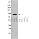 DF8373 staining Hela by IF/ICC. The sample were fixed with PFA and permeabilized in 0.1% Triton X-100,then blocked in 10% serum for 45 minutes at 25¡ãC. The primary antibody was diluted at 1/200 and incubated with the sample for 1 hour at 37¡ãC. An Alexa Fluor 594 conjugated goat anti-rabbit IgG (H+L) Ab, diluted at 1/600, was used as the secondary antibod