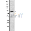Western blot analysis of extracts from MCF7, using KITH_HHV11 Antibody. The lane on the left was treated with blocking peptide.