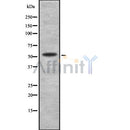 Western blot analysis of extracts from B16F10, using KR2_HHV11 Antibody. The lane on the left was treated with blocking peptide.