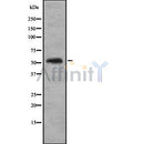 Western blot analysis of extracts from HepG2, using KR1_HHV11 Antibody. The lane on the left was treated with blocking peptide.