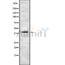 DF8778 staining HuvEc/RAW by IF/ICC. The sample were fixed with PFA and permeabilized in 0.1% Triton X-100,then blocked in 10% serum for 45 minutes at 25¡ãC. The primary antibody was diluted at 1/200 and incubated with the sample for 1 hour at 37¡ãC. An Alexa Fluor 594 conjugated goat anti-rabbit IgG (H+L) Ab, diluted at 1/600, was used as the secondary antibod