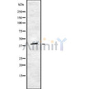 DF8779 staining HepG2 by IF/ICC. The sample were fixed with PFA and permeabilized in 0.1% Triton X-100,then blocked in 10% serum for 45 minutes at 25¡ãC. The primary antibody was diluted at 1/200 and incubated with the sample for 1 hour at 37¡ãC. An Alexa Fluor 594 conjugated goat anti-rabbit IgG (H+L) Ab, diluted at 1/600, was used as the secondary antibod