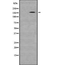 DF8784 at 1/100 staining Human lung tissue by IHC-P. The sample was formaldehyde fixed and a heat mediated antigen retrieval step in citrate buffer was performed. The sample was then blocked and incubated with the antibody for 1.5 hours at 22¡ãC. An HRP conjugated goat anti-rabbit antibody was used as the secondary
