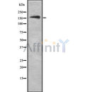 Western blot analysis NKTR using RAW264.7 whole cell lysates