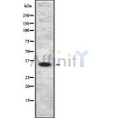 Western blot analysis of MAGEA9 using HuvEc whole cell lysates