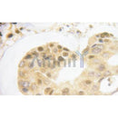 AF3056 staining HeLa by IF/ICC. The sample were fixed with PFA and permeabilized in 0.1% Triton X-100,then blocked in 10% serum for 45 minutes at 25¡ãC. The primary antibody was diluted at 1/200 and incubated with the sample for 1 hour at 37¡ãC. An Alexa Fluor 594 conjugated goat anti-rabbit IgG (H+L) Ab, diluted at 1/600, was used as the secondary antibod