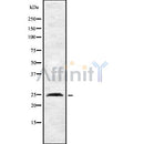 Western blot analysis INSIG2 using HeLa whole cell lysates