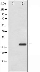 AF3080 staining HeLa by IF/ICC. The sample were fixed with PFA and permeabilized in 0.1% Triton X-100,then blocked in 10% serum for 45 minutes at 25¡ãC. The primary antibody was diluted at 1/200 and incubated with the sample for 1 hour at 37¡ãC. An Alexa Fluor 594 conjugated goat anti-rabbit IgG (H+L) Ab, diluted at 1/600, was used as the secondary antibod
