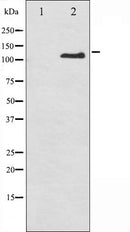 AF3086 staining HepG2 by IF/ICC. The sample were fixed with PFA and permeabilized in 0.1% Triton X-100,then blocked in 10% serum for 45 minutes at 25¡ãC. The primary antibody was diluted at 1/200 and incubated with the sample for 1 hour at 37¡ãC. An Alexa Fluor 594 conjugated goat anti-rabbit IgG (H+L) Ab, diluted at 1/600, was used as the secondary antibod