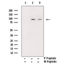 AF3098 at 1/100 staining human Brain tissue sections by IHC-P. The tissue was formaldehyde fixed and a heat mediated antigen retrieval step in citrate buffer was performed. The tissue was then blocked and incubated with the antibody for 1.5 hours at 22¡ãC. An HRP conjugated goat anti-rabbit antibody was used as the secondary