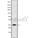 Western blot analysis of extracts from mouse brain, using C1QL4 Antibody. Lane 1 was treated with the blocking peptide.