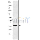 Western blot analysis of CFD using K562 whole cell lysates