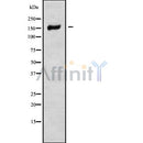 Western blot analysis NCAPD3 using LOVO whole cell lysates