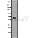 Western blot analysis of HSD11B2 using COLO205 whole cell lysates