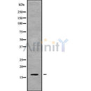 Western blot analysis of CST8 using Jurkat whole cell lysates