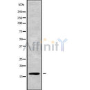 Western blot analysis of CST5 using NIH-3T3 whole cell lysates