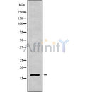 DF9426 at 1/100 staining Human Melanoma tissue by IHC-P. The sample was formaldehyde fixed and a heat mediated antigen retrieval step in citrate buffer was performed. The sample was then blocked and incubated with the antibody for 1.5 hours at 22¡ãC. An HRP conjugated goat anti-rabbit antibody was used as the secondary