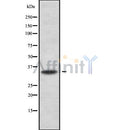 Western blot analysis of extracts from rat brain, using DHRS1 Antibody. Lane 1 was treated with the blocking peptide.