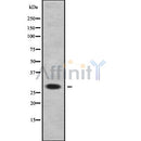 Western blot analysis of DHRS11 using Jurkat whole cell lysates