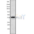 Western blot analysis of DHRS7 using Jurkat whole cell lysates