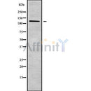 Western blot analysis of DSG4 using HeLa whole cell lysates