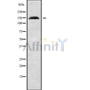 Western blot analysis of extracts from HepG2, using POLG1 Antibody. The lane on the left was treated with blocking peptide.
