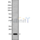 Western blot analysis of POLR1D using COLO205 whole cell lysates
