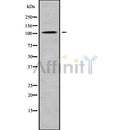 DF9477 at 1/100 staining Human brain cancer tissue by IHC-P. The sample was formaldehyde fixed and a heat mediated antigen retrieval step in citrate buffer was performed. The sample was then blocked and incubated with the antibody for 1.5 hours at 22¡ãC. An HRP conjugated goat anti-rabbit antibody was used as the secondary