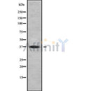 Western blot analysis FAIM2 using COLO205 whole cell lysates