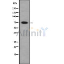 Western blot analysis FIGNL1 using HeLa whole cell lysates